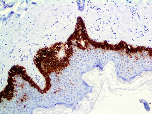 IHC of Cytokeratin 15 on an FFPE Skin Tissue